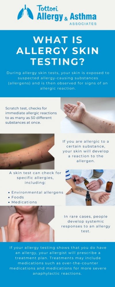 What is Allergy Skin Testing? - Tottori Allergy & Asthma Associates