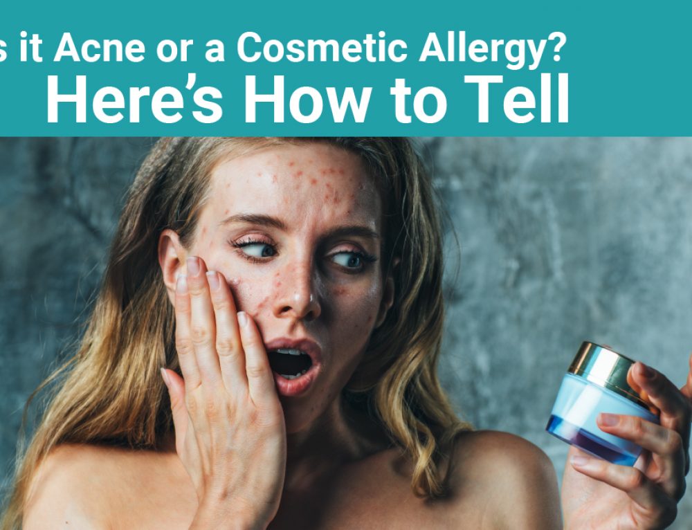 What is Allergy Skin Testing? Tottori Allergy & Asthma Associates