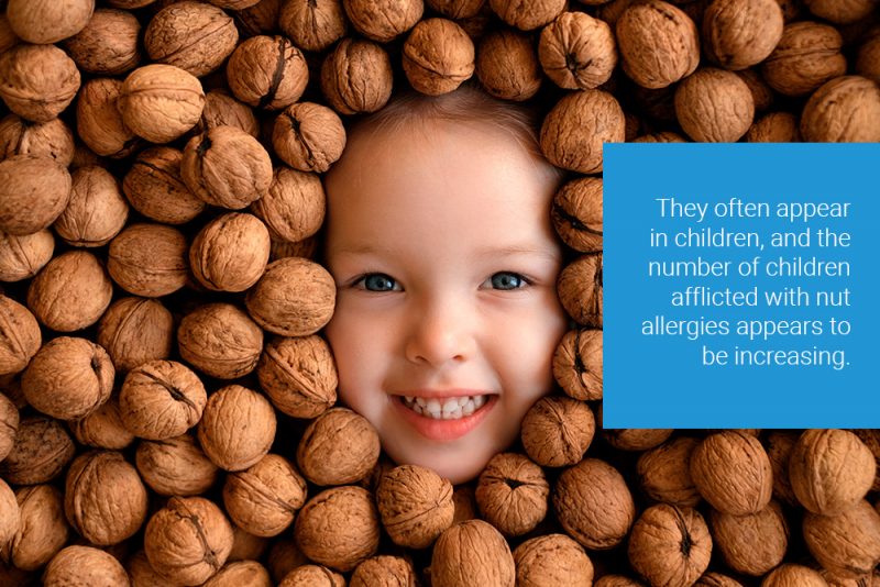 What You Need to Know About Nut Allergies Tottori Allergy & Asthma Associates