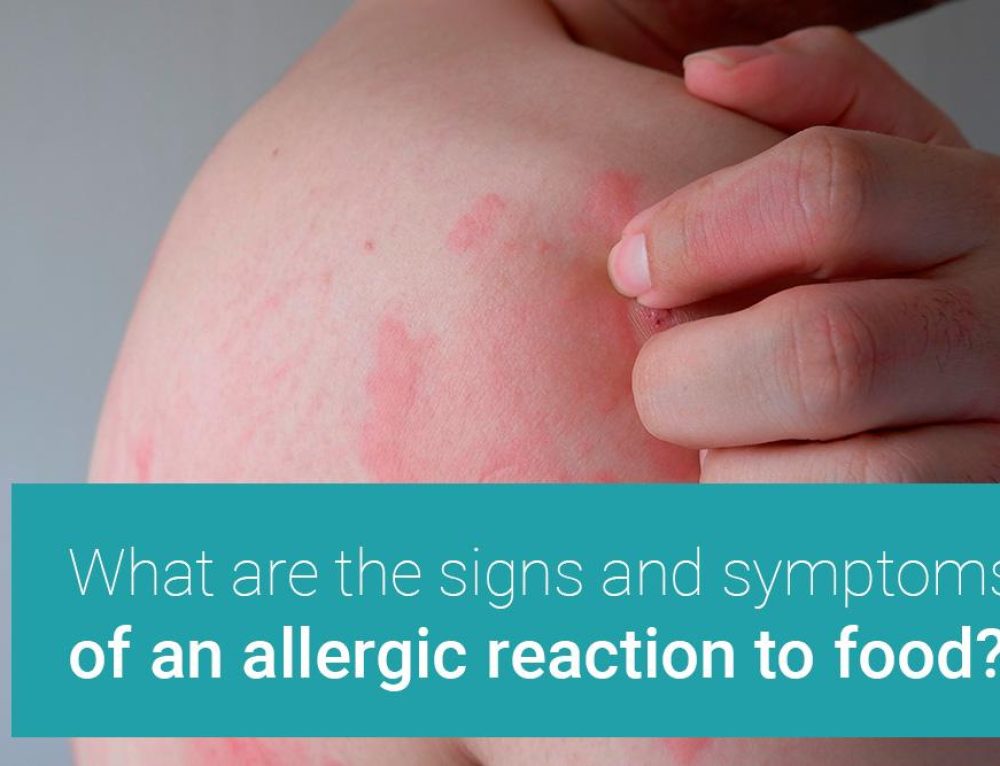 Four Hidden Food Ingredients That May Be Causing Your Allergic Reaction