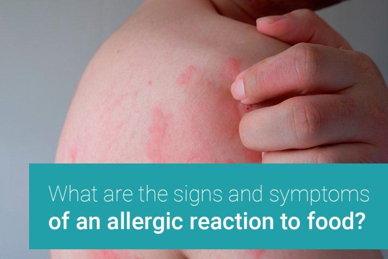 What are the signs and symptoms of an allergic reaction to food
