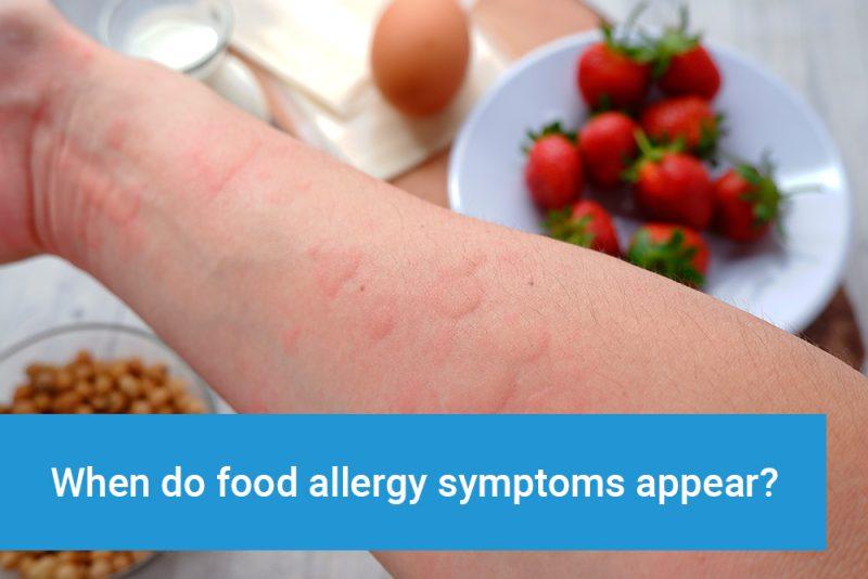 What are the signs and symptoms of an allergic reaction to food